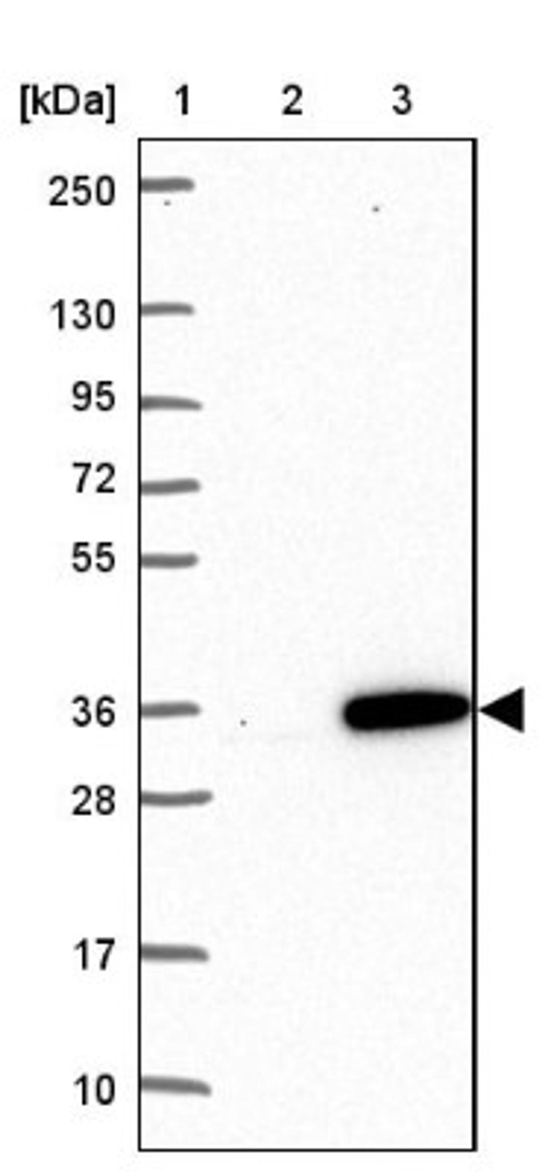 Western Blot: RAB15 Antibody [NBP1-86231] - Lane 1: Marker [kDa] 250, 130, 95, 72, 55, 36, 28, 17, 10<br/>Lane 2: Negative control (vector only transfected HEK293T lysate)<br/>Lane 3: Over-expression lysate (Co-expressed with a C-terminal myc-DDK tag (~3.1 kDa) in mammalian HEK293T cells, LY404805)