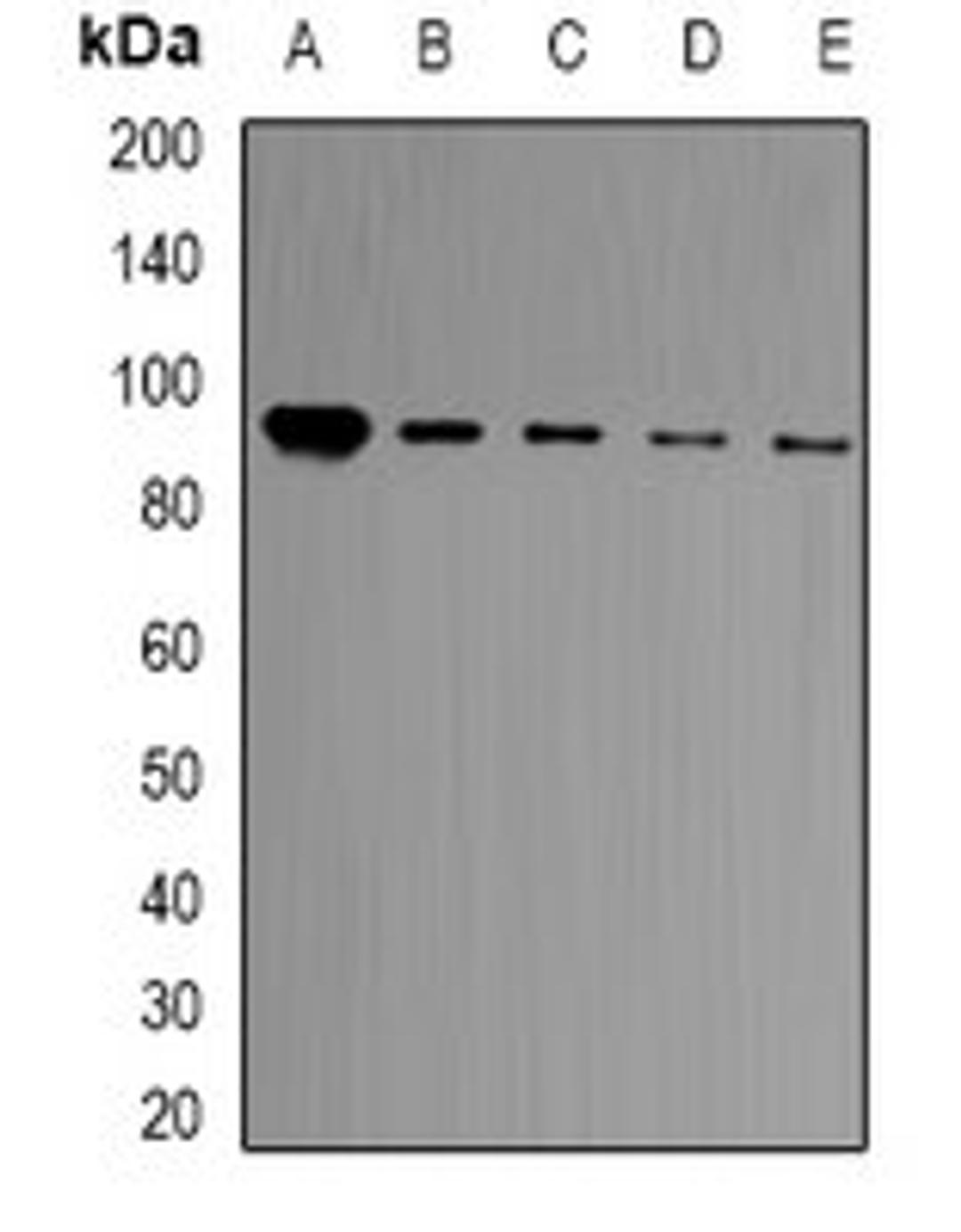 Western blot analysis of HT29 (Lane1), Jurkat (Lane2), Hela (Lane3), A549 (Lane4), mouse brain (Lane5) whole cell lysates using BCL11A antibody