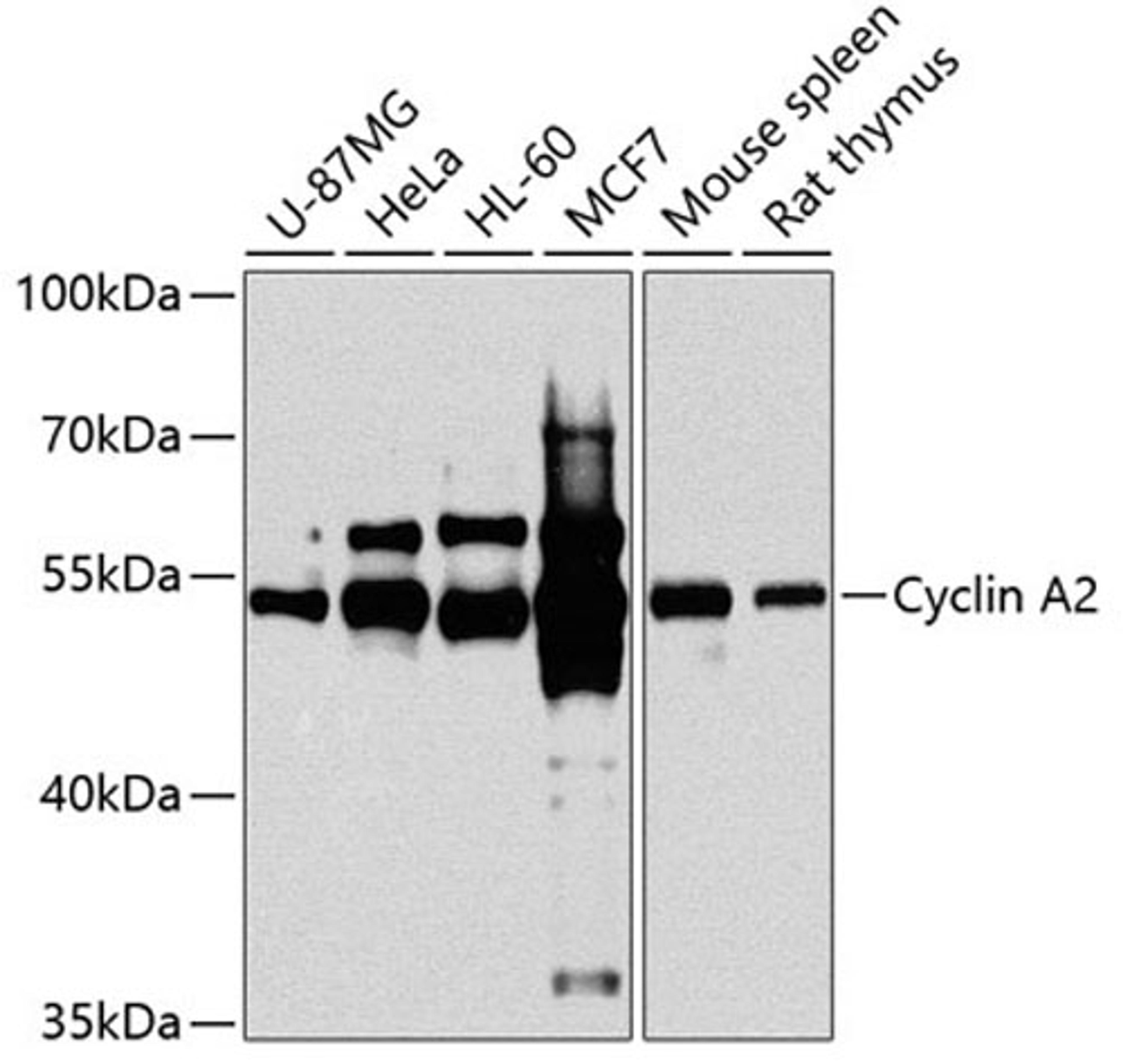 Western blot - Cyclin A2 antibody (A2891)