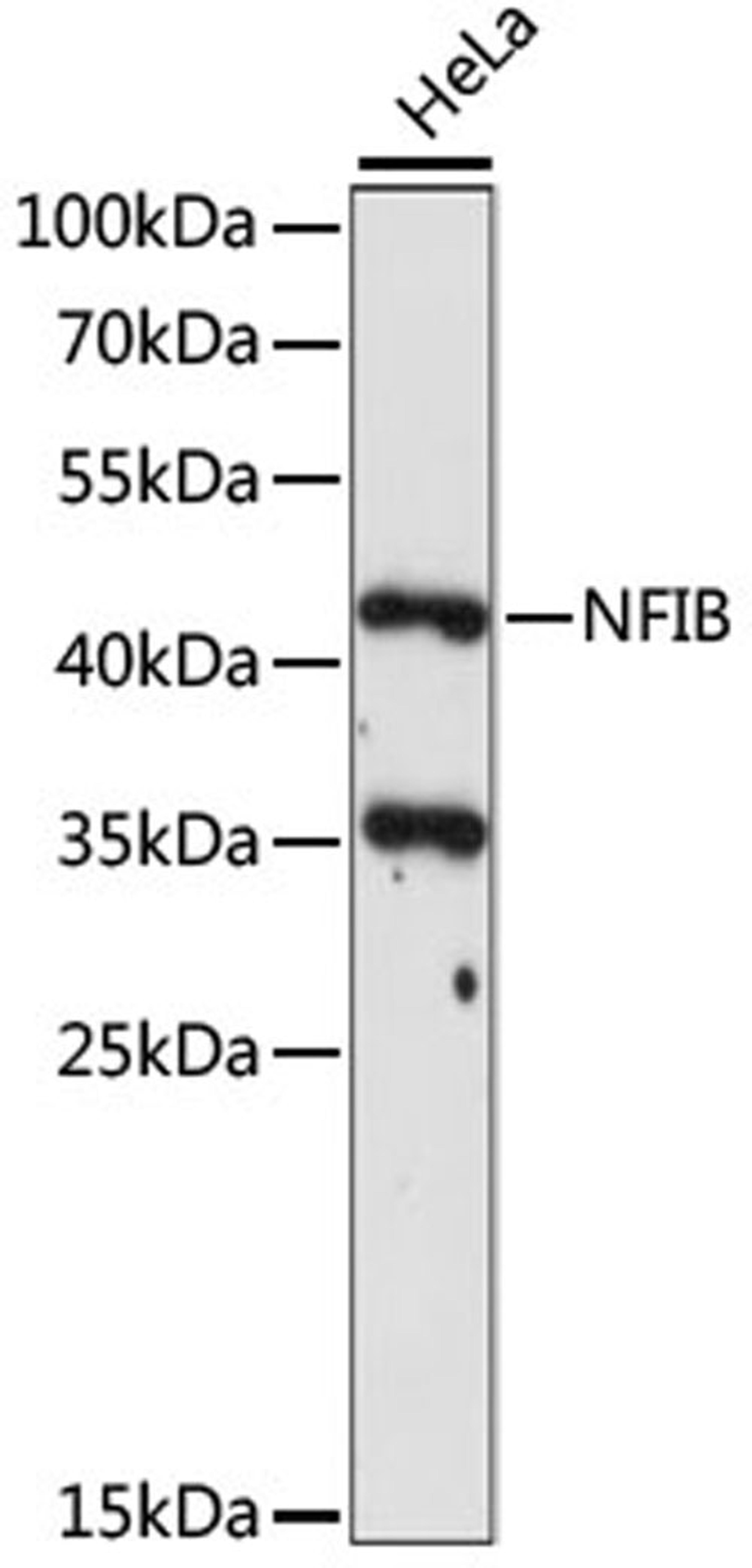 Western blot - NFIB antibody (A15294)