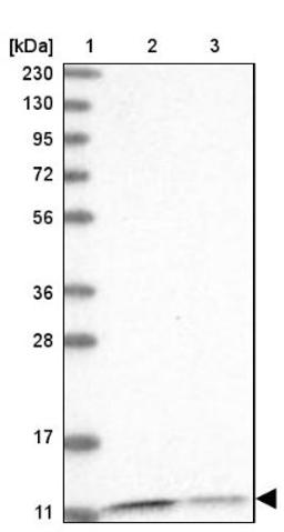 Western Blot: PCBD1 Antibody [NBP1-84297] - Lane 1: Marker [kDa] 230, 130, 95, 72, 56, 36, 28, 17, 11<br/>Lane 2: Human cell line RT-4<br/>Lane 3: Human cell line U-251MG sp