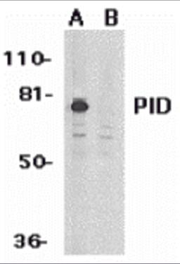 Western blot analysis of PID expression in HeLa whole cell lysates in the absence (A) or presence (B) of blocking peptide with PID antibody at 1 &#956;g/mL. 