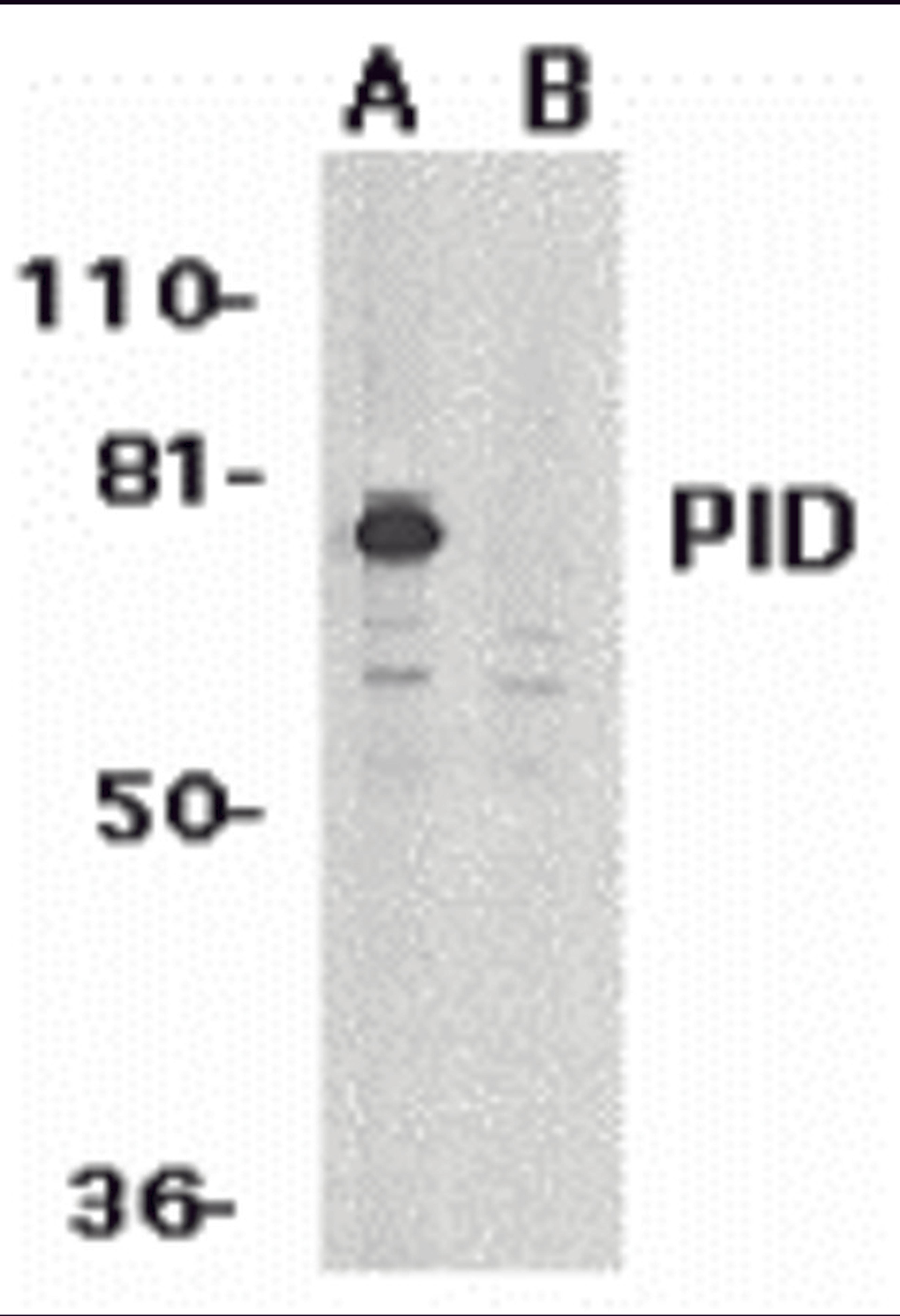 Western blot analysis of PID expression in HeLa whole cell lysates in the absence (A) or presence (B) of blocking peptide with PID antibody at 1 &#956;g/mL. 