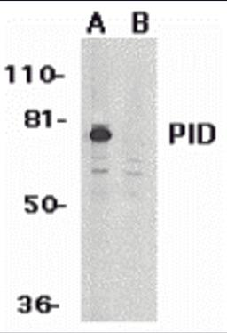 Western blot analysis of PID expression in HeLa whole cell lysates in the absence (A) or presence (B) of blocking peptide with PID antibody at 1 μg/mL.