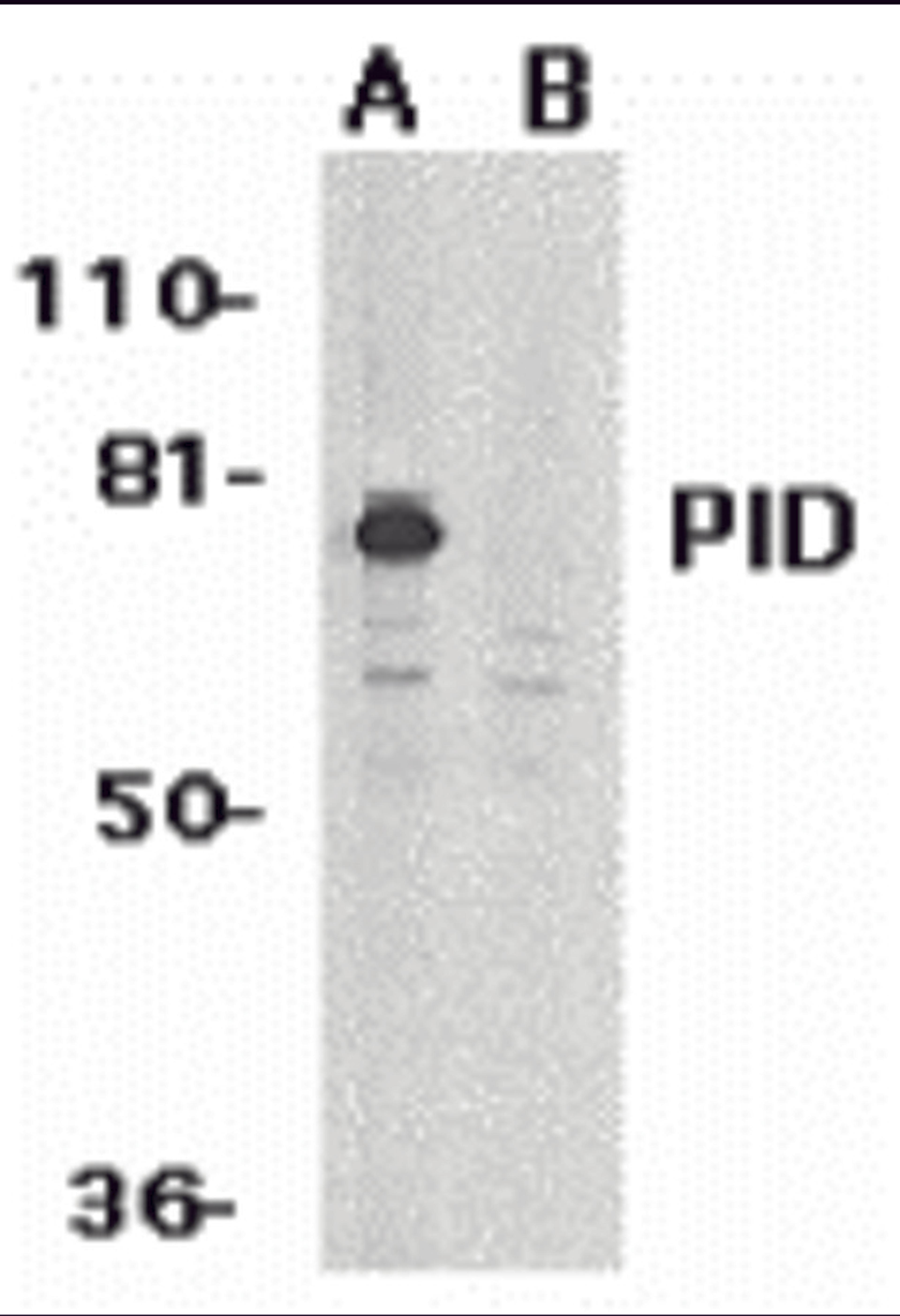 Western blot analysis of PID expression in HeLa whole cell lysates in the absence (A) or presence (B) of blocking peptide with PID antibody at 1 μg/mL.
