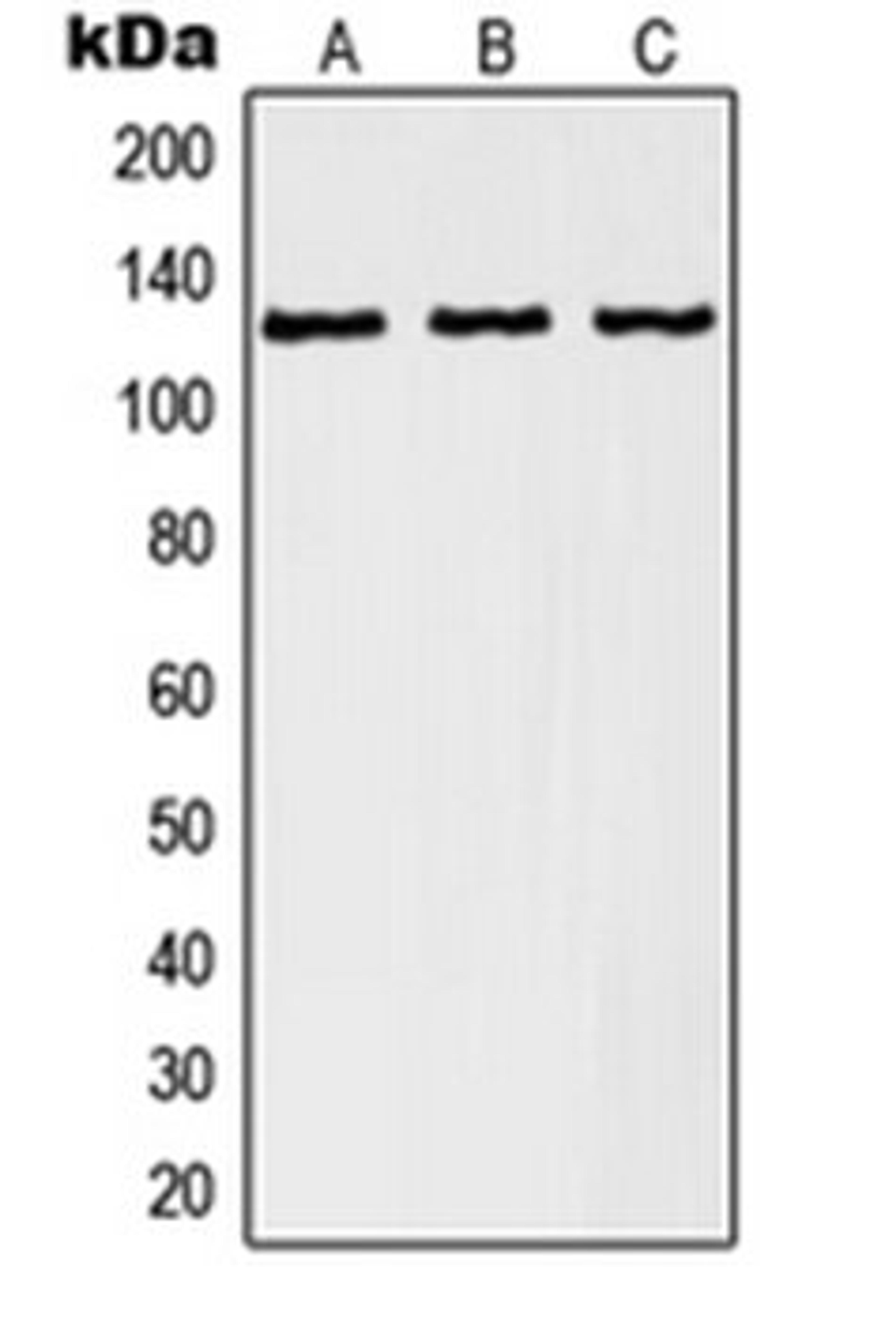 Western blot analysis of A549 (Lane 1), K562 (Lane 2), human kidney (Lane 3) whole cell lysates using RANBP6 antibody