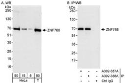 Detection of human ZNF768 by western blot and immunoprecipitation.