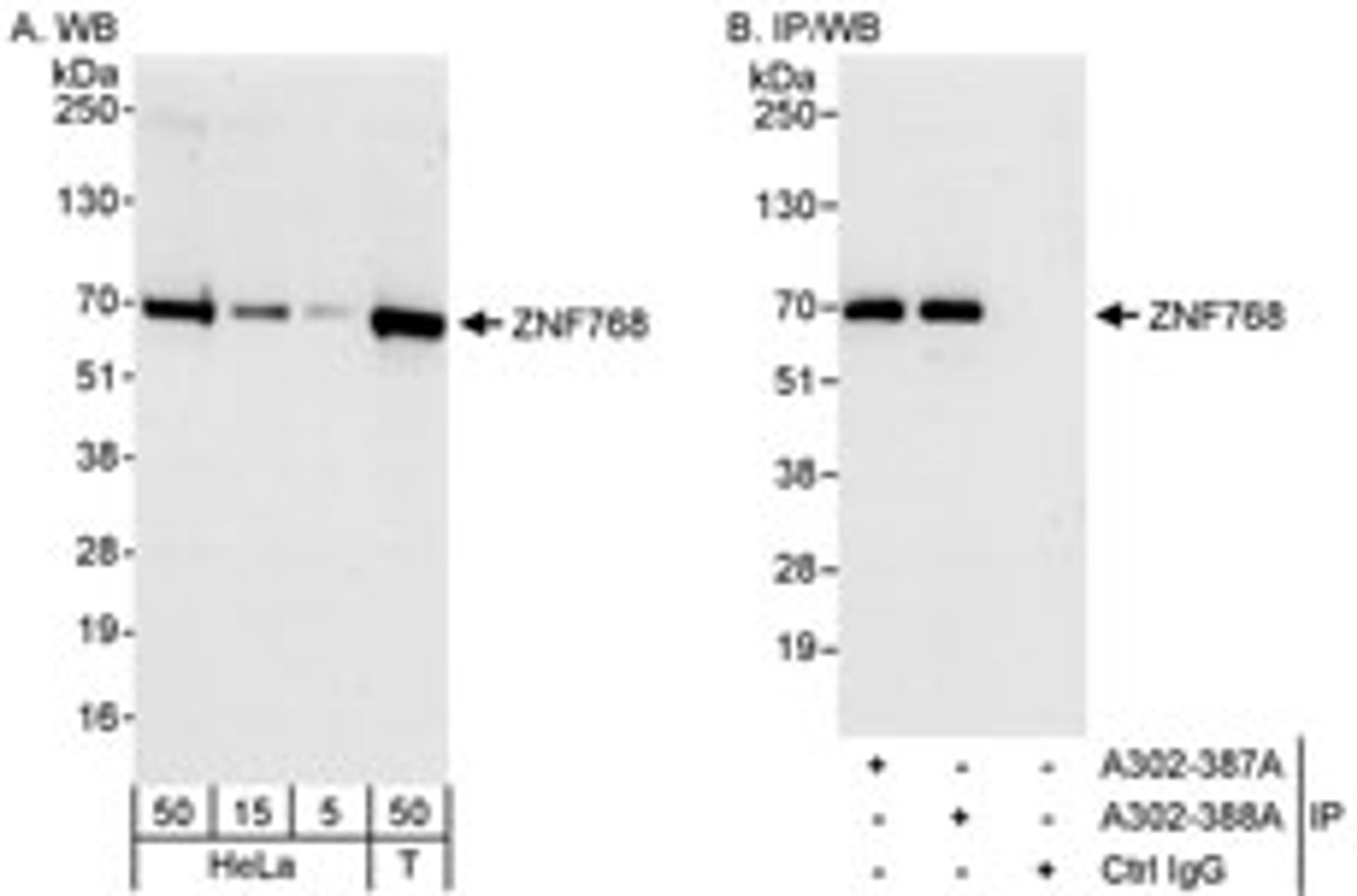 Detection of human ZNF768 by western blot and immunoprecipitation.