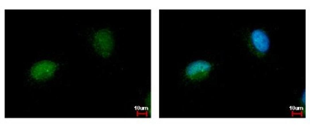 Immunocytochemistry/Immunofluorescence: NARF Antibody [NBP2-19474] - Sample: HeLa cells were fixed in 4% paraformaldehyde at RT for 15 min. Green: NARF protein stained by NARF antibody diluted at 1:500. Blue: Hoechst 33342 staining.