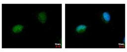 Immunocytochemistry/Immunofluorescence: NARF Antibody [NBP2-19474] - Sample: HeLa cells were fixed in 4% paraformaldehyde at RT for 15 min. Green: NARF protein stained by NARF antibody diluted at 1:500. Blue: Hoechst 33342 staining.