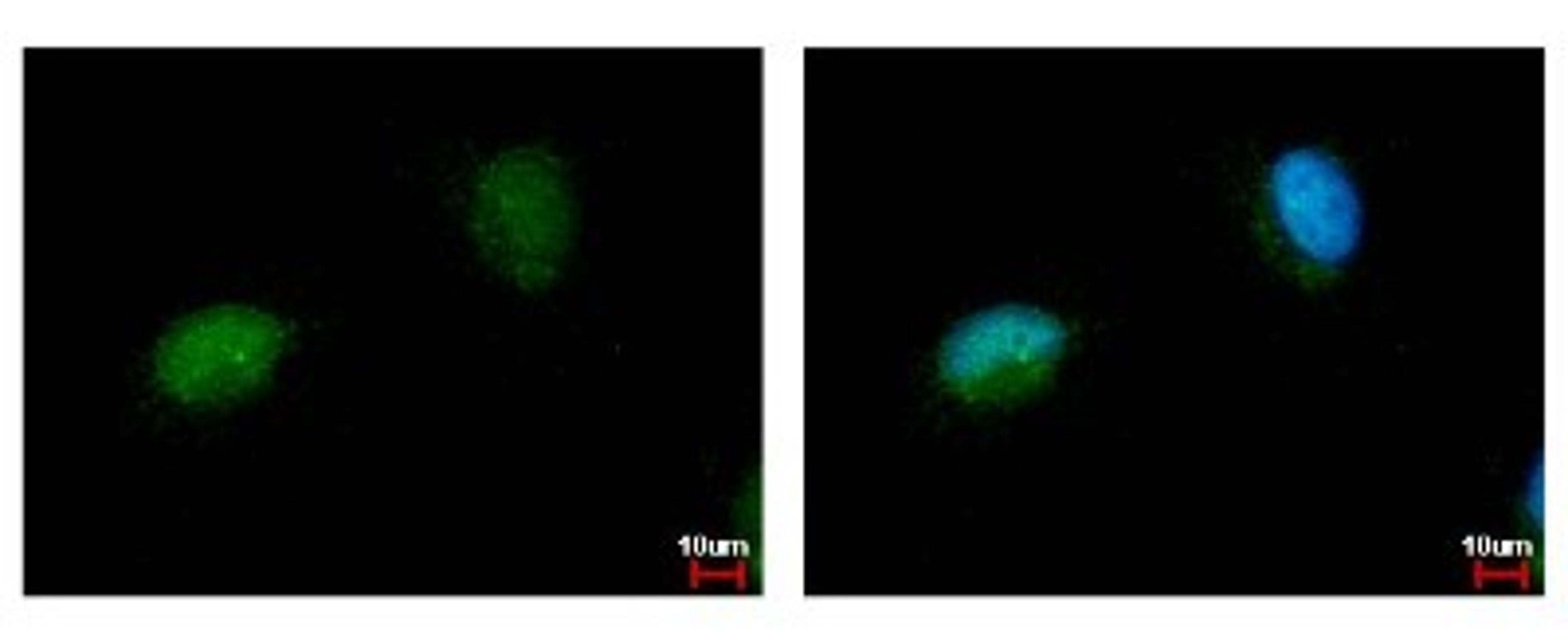 Immunocytochemistry/Immunofluorescence: NARF Antibody [NBP2-19474] - Sample: HeLa cells were fixed in 4% paraformaldehyde at RT for 15 min. Green: NARF protein stained by NARF antibody diluted at 1:500. Blue: Hoechst 33342 staining.