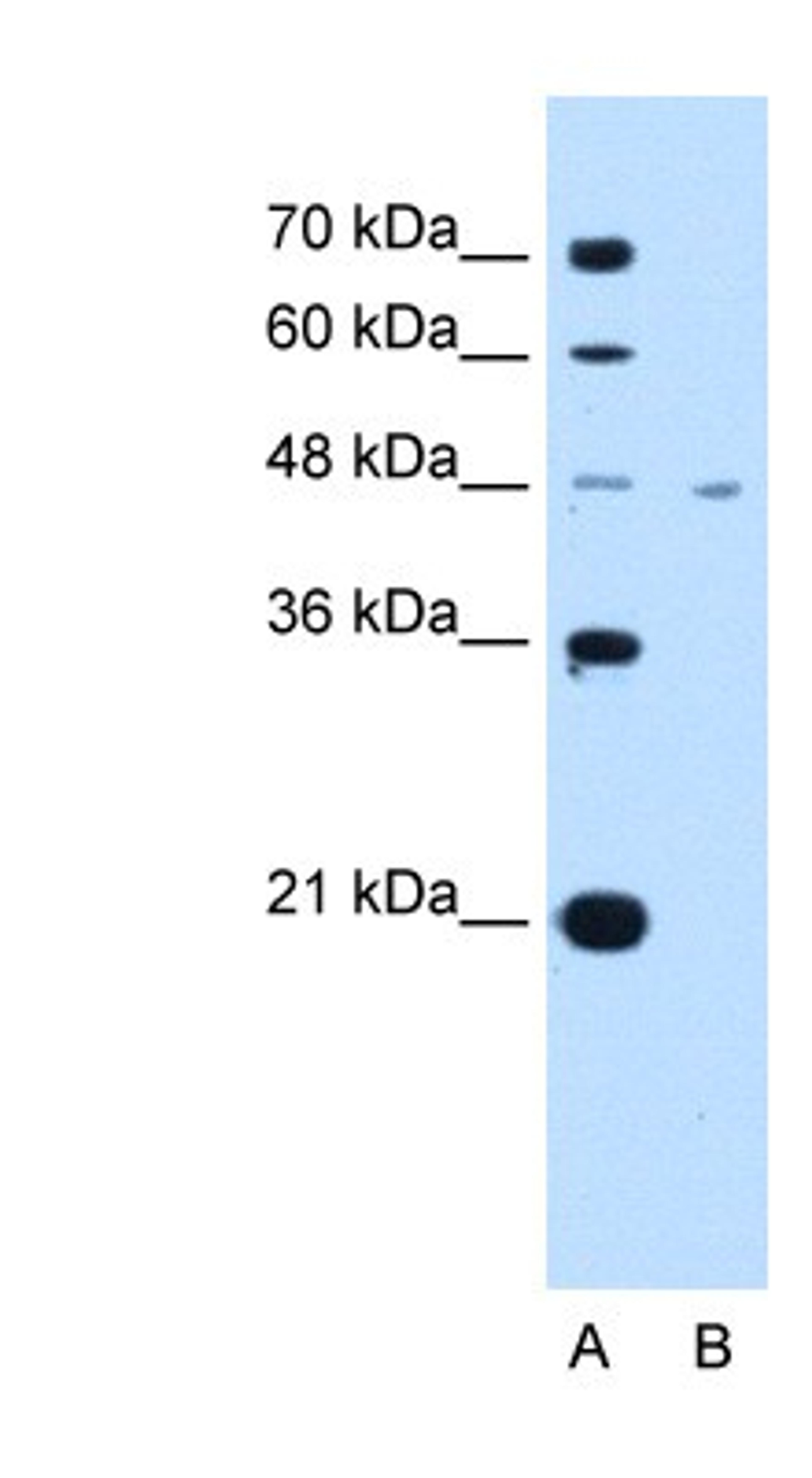 Western Blot: Monocarboxylic acid transporter 1 Antibody [NBP1-59656] - Jurkat cell lysate, concentration 2.5 ug/ml.