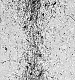 Immunohistochemistry-Paraffin: GnRH Antibody [NB300-506] - Analysis of Hyla cinerea (green treefrog) forebrain using GnRH Polyclonal Antibody. Tissues were blocked in 10% normal goat serum in 0.1M PBS and then stained. Staining was developed with DAB substrate for 10 minutes. Data courtesy of Innovators Program.