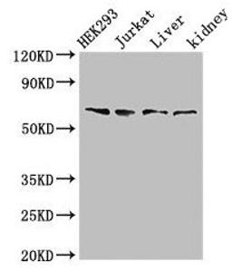 Western Blot. Positive WB detected in: HEK293 whole cell lysate, Jurkat whole cell lysate, Rat liver tissue, Rat kidney tissue. All lanes: TXK antibody at 3µg/ml. Secondary. Goat polyclonal to rabbit IgG at 1/50000 dilution. Predicted band size: 62 kDa. Observed band size: 62 kDa