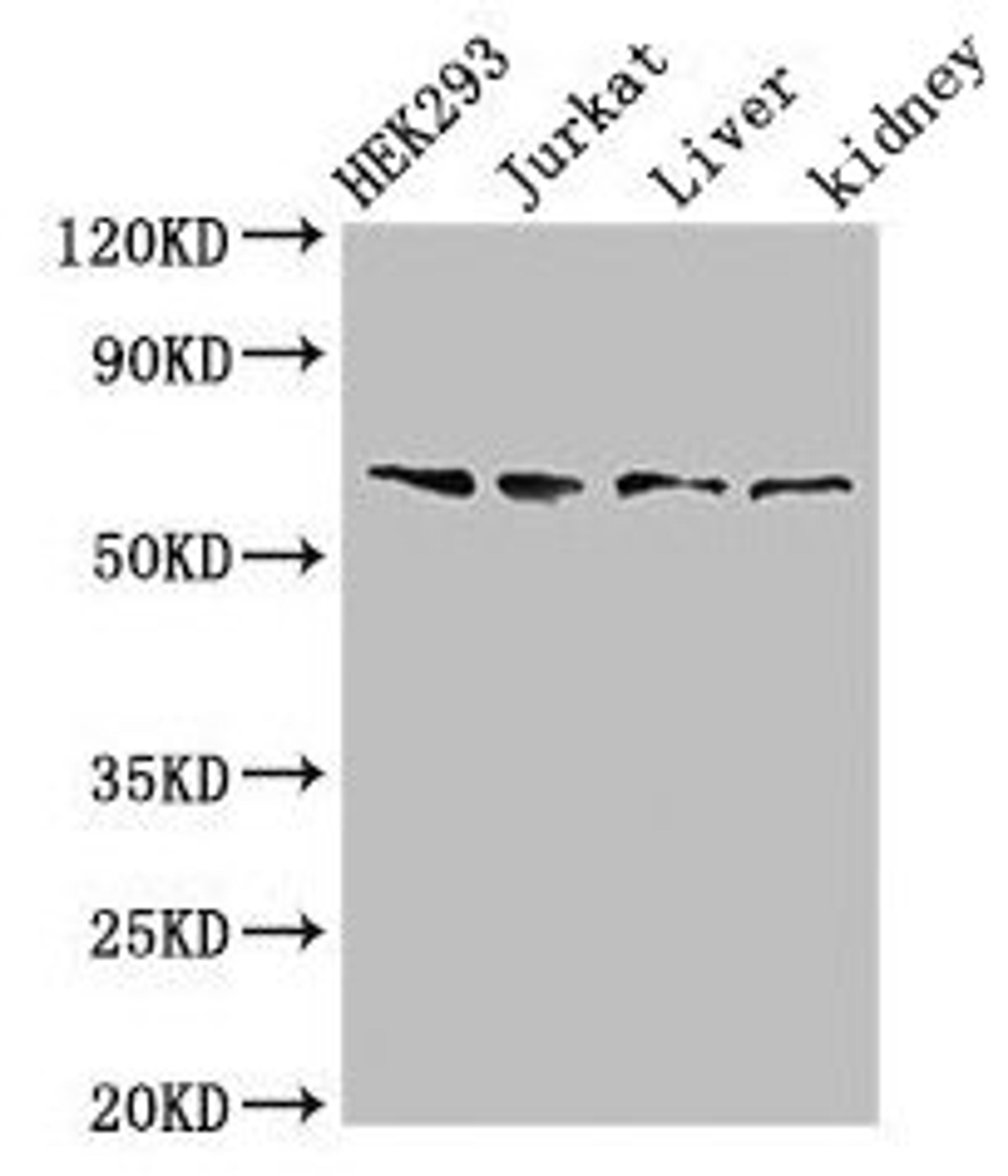 Western Blot. Positive WB detected in: HEK293 whole cell lysate, Jurkat whole cell lysate, Rat liver tissue, Rat kidney tissue. All lanes: TXK antibody at 3µg/ml. Secondary. Goat polyclonal to rabbit IgG at 1/50000 dilution. Predicted band size: 62 kDa. Observed band size: 62 kDa