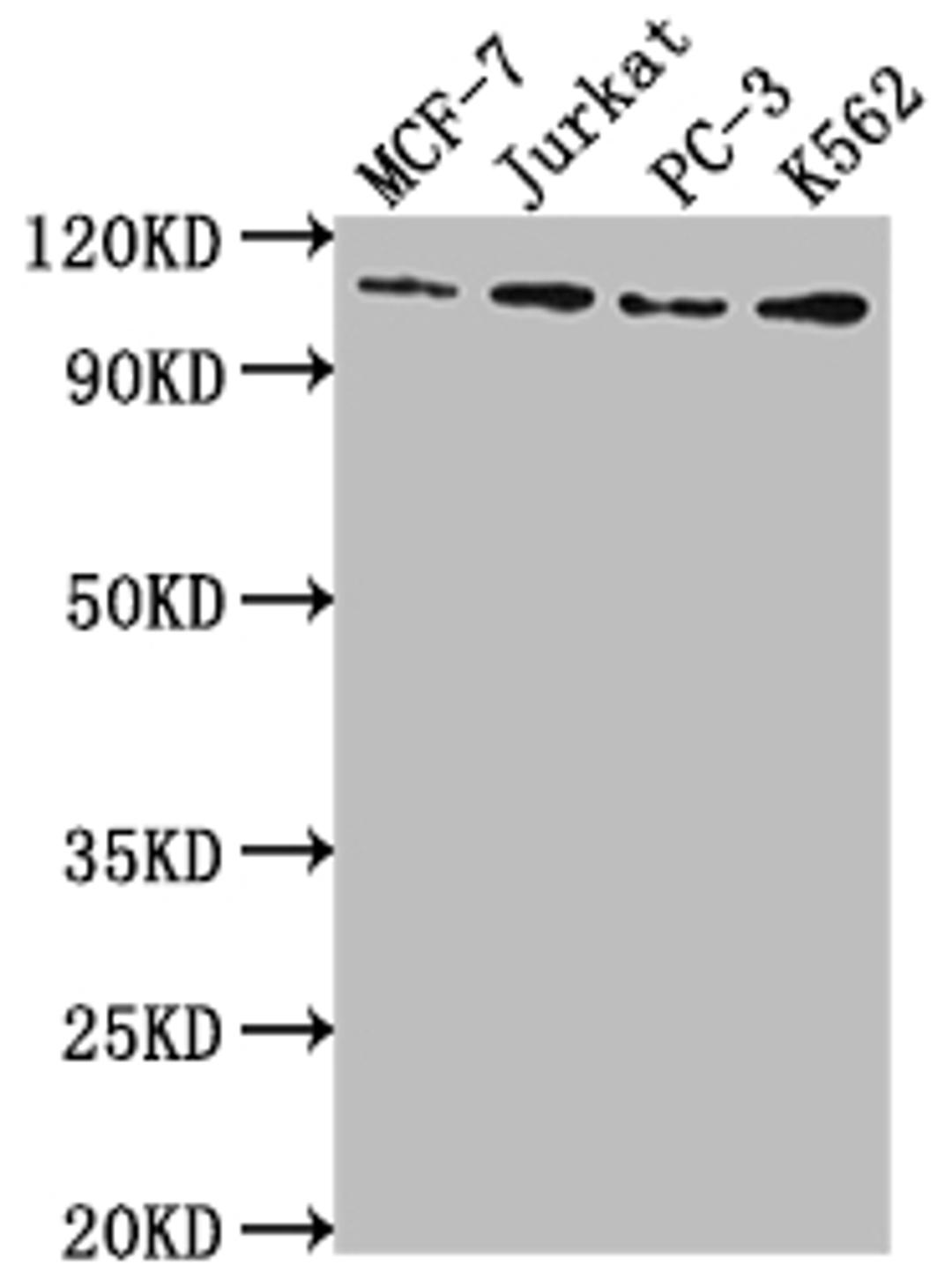 Western Blot. Positive WB detected in: MCF-7 whole cell lysate, Jurkat whole cell lysate, PC-3 whole cell lysate, K562 whole cell lysate. All lanes: KDM1A antibody at 1:2000. Secondary. Goat polyclonal to rabbit IgG at 1/50000 dilution. Predicted band size: 93, 96 kDa. Observed band size: 110 kDa. 