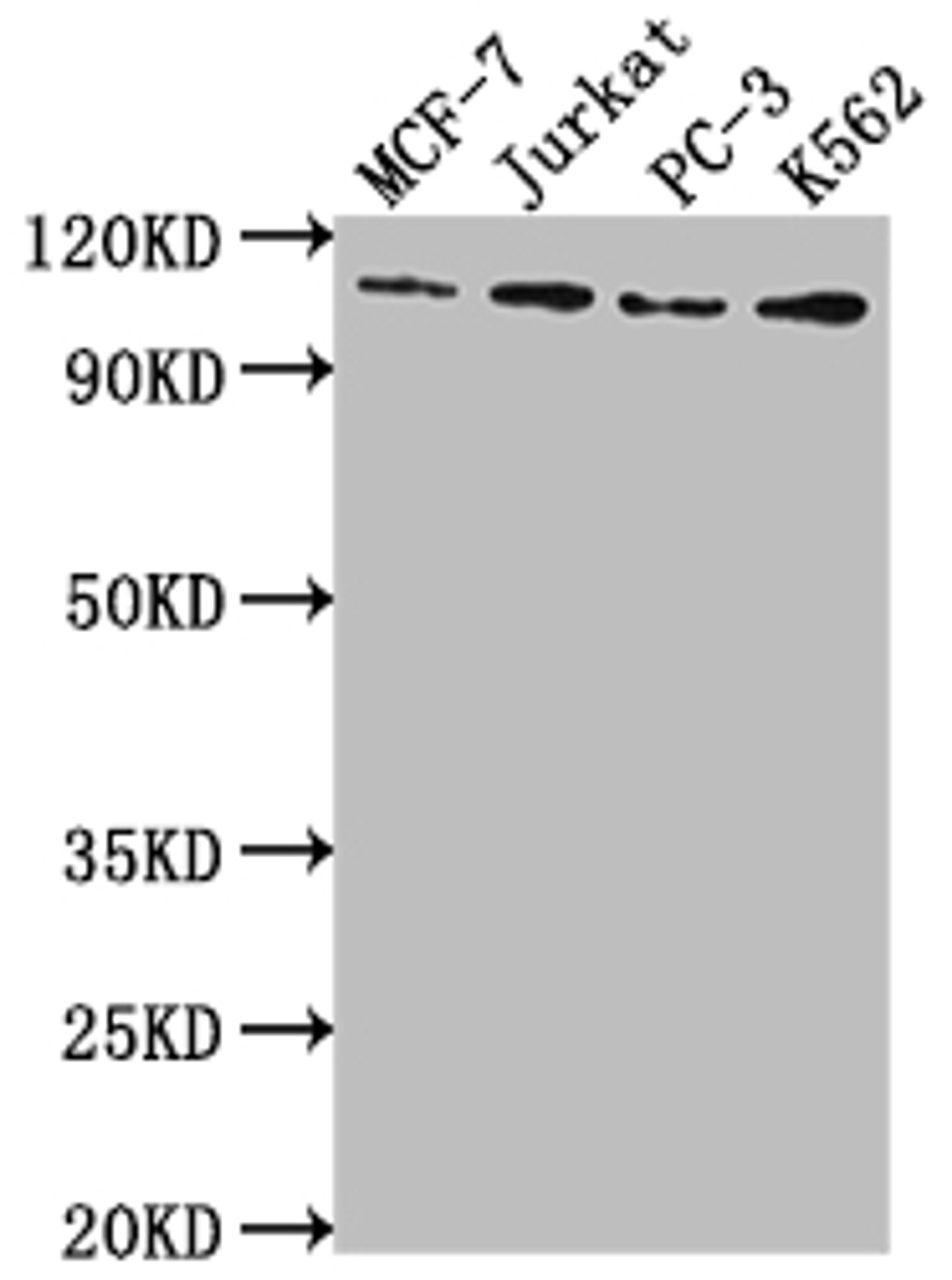 Western Blot. Positive WB detected in: MCF-7 whole cell lysate, Jurkat whole cell lysate, PC-3 whole cell lysate, K562 whole cell lysate. All lanes: KDM1A antibody at 1:2000. Secondary. Goat polyclonal to rabbit IgG at 1/50000 dilution. Predicted band size: 93, 96 kDa. Observed band size: 110 kDa. 