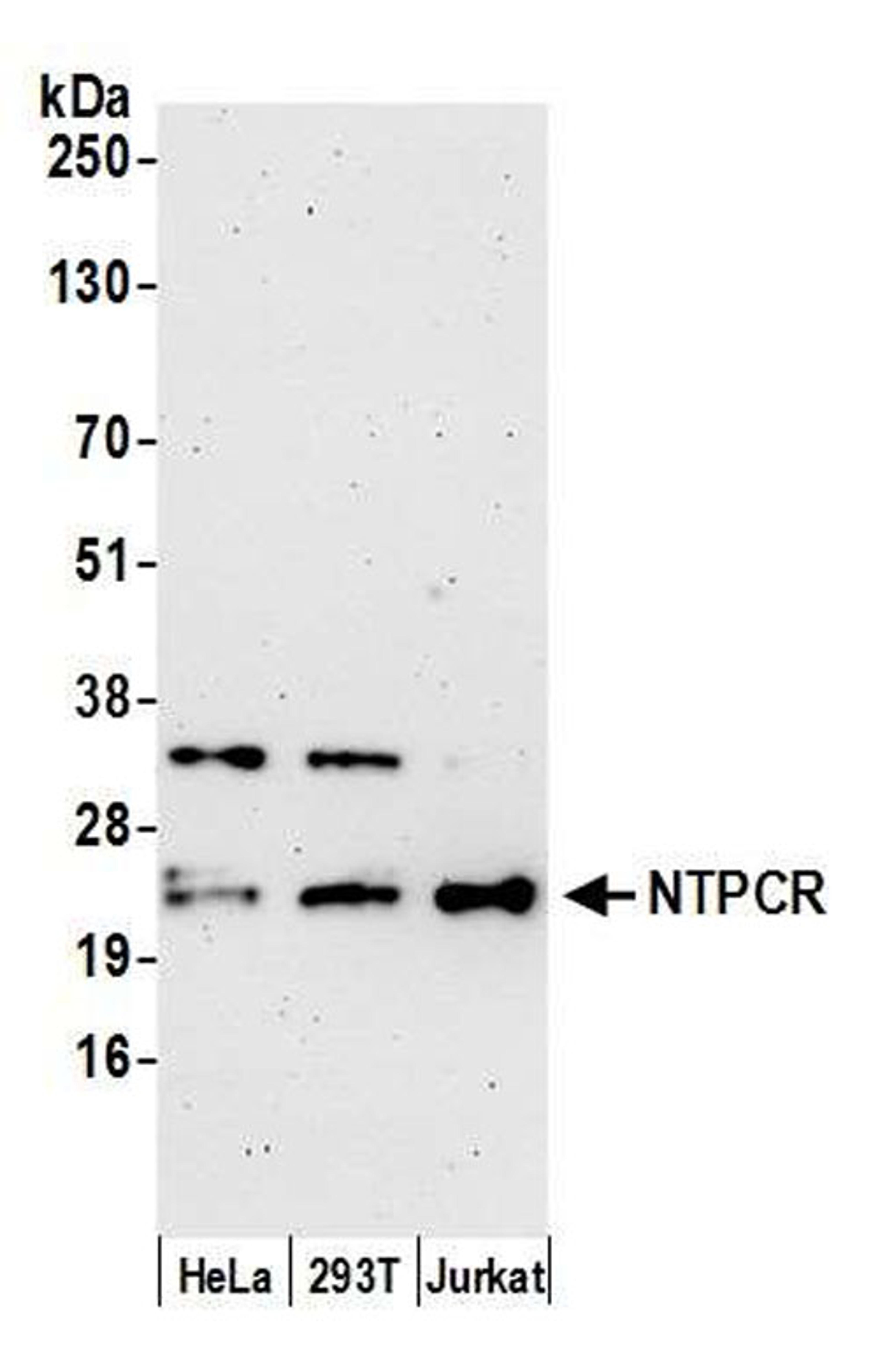 Detection of human NTPCR by WB.