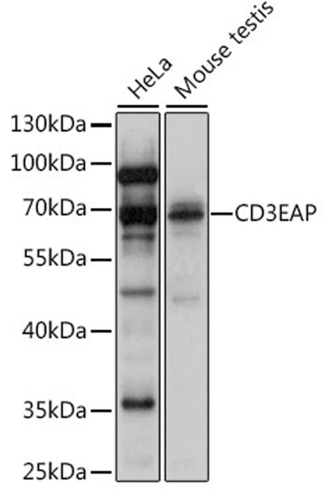 Western blot - CD3EAP antibody (A16099)