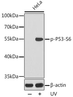 Western blot - Phospho-p53-S6 antibody (AP0157)