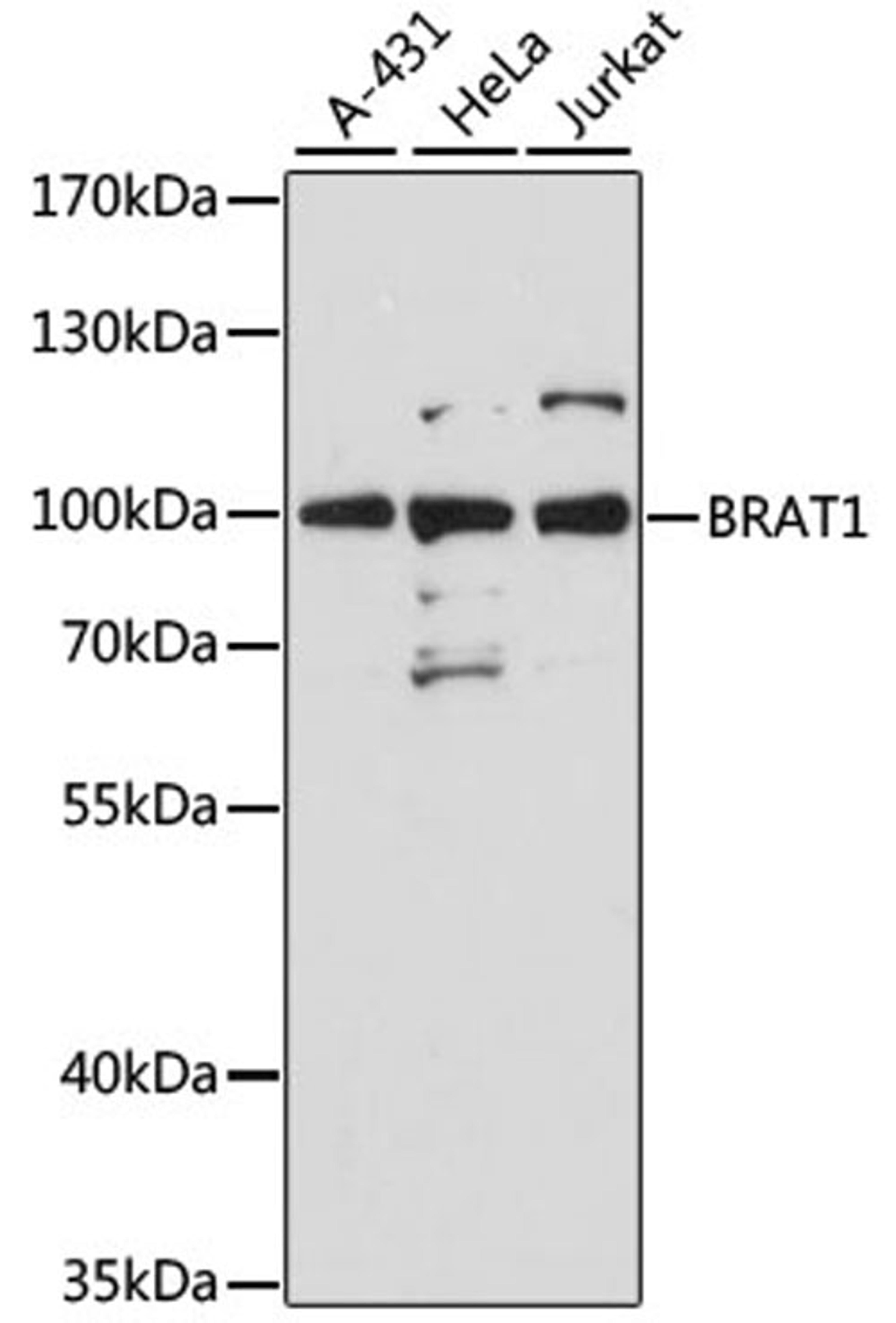 Western blot - Brat1 antibody (A12801)