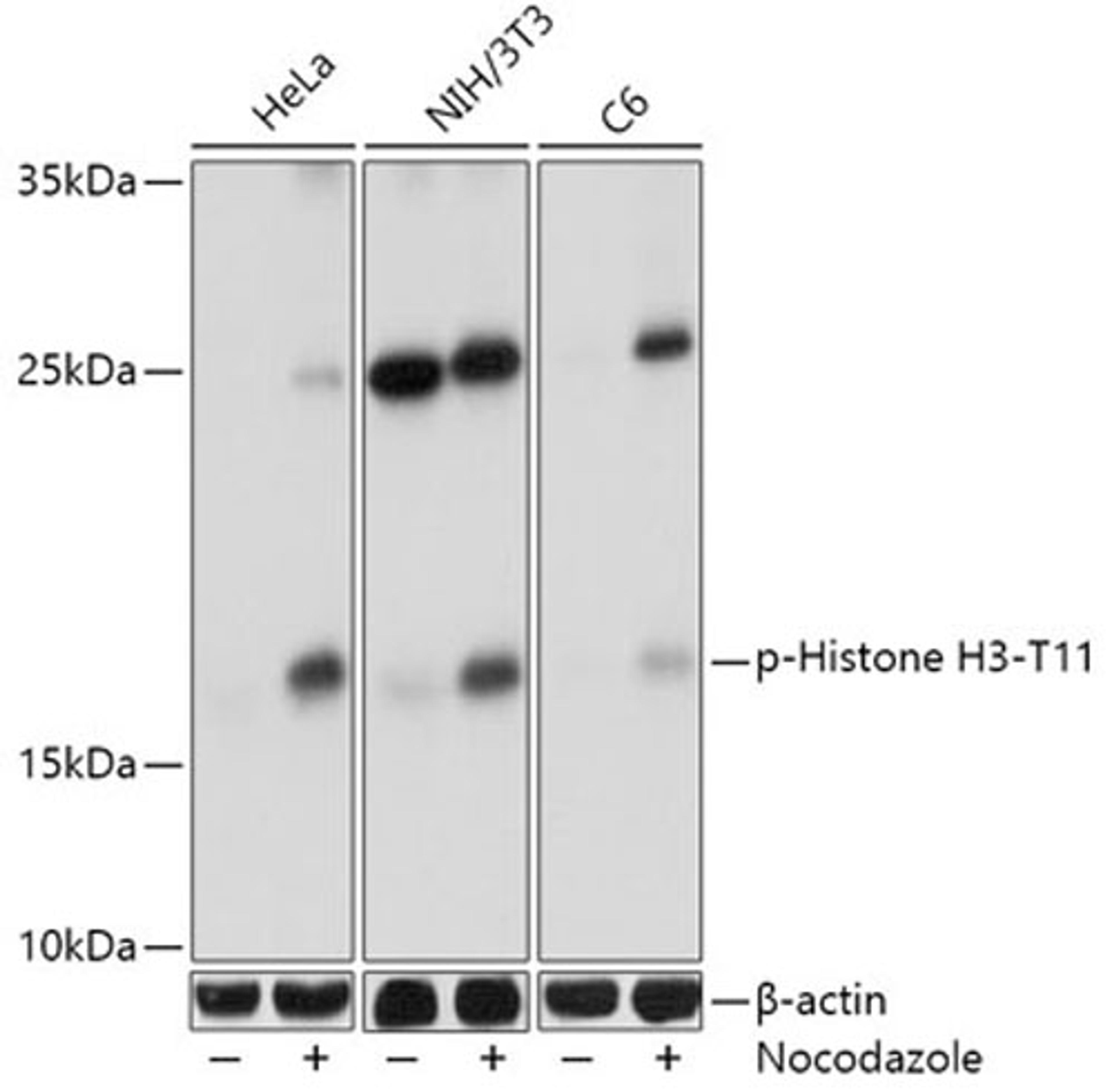 Western blot - Phospho-Histone H3-T11 antibody (AP0093)