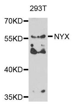 Western blot analysis of extracts of 293T cells using NYX antibody