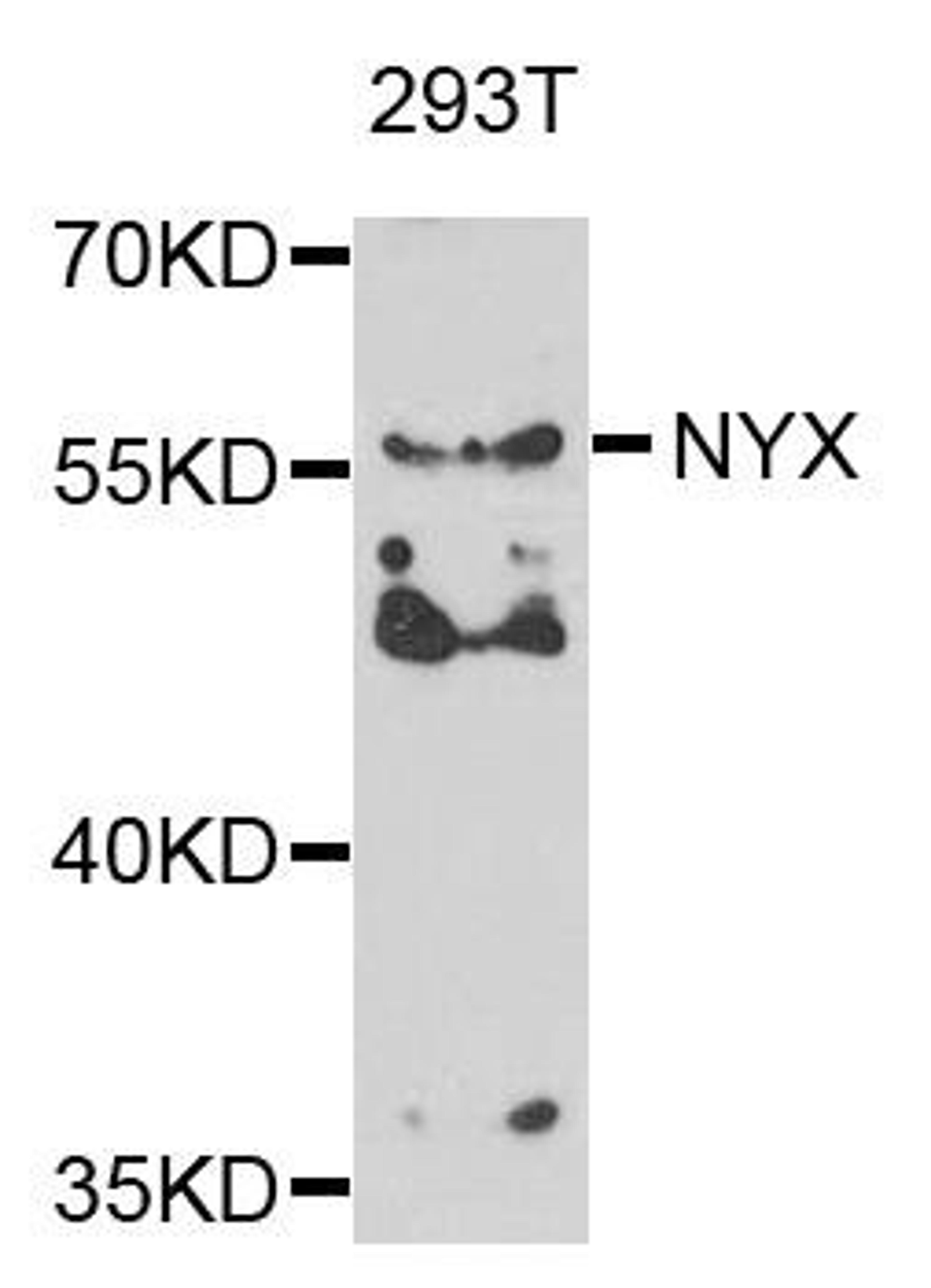 Western blot analysis of extracts of 293T cells using NYX antibody