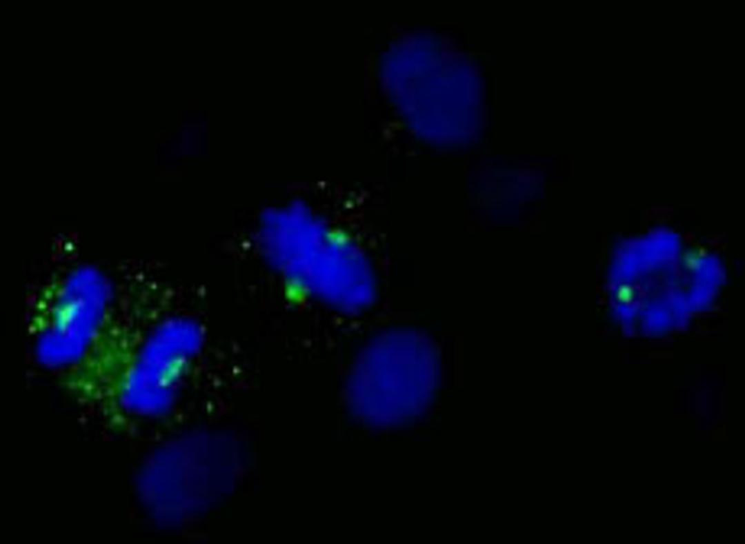 Detection of human CDK5RAP2 by immunocytochemistry.