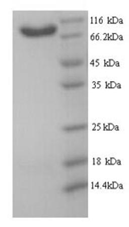 (Tris-Glycine gel) Discontinuous SDS-PAGE (reduced) with 5% enrichment gel and 15% separation gel.