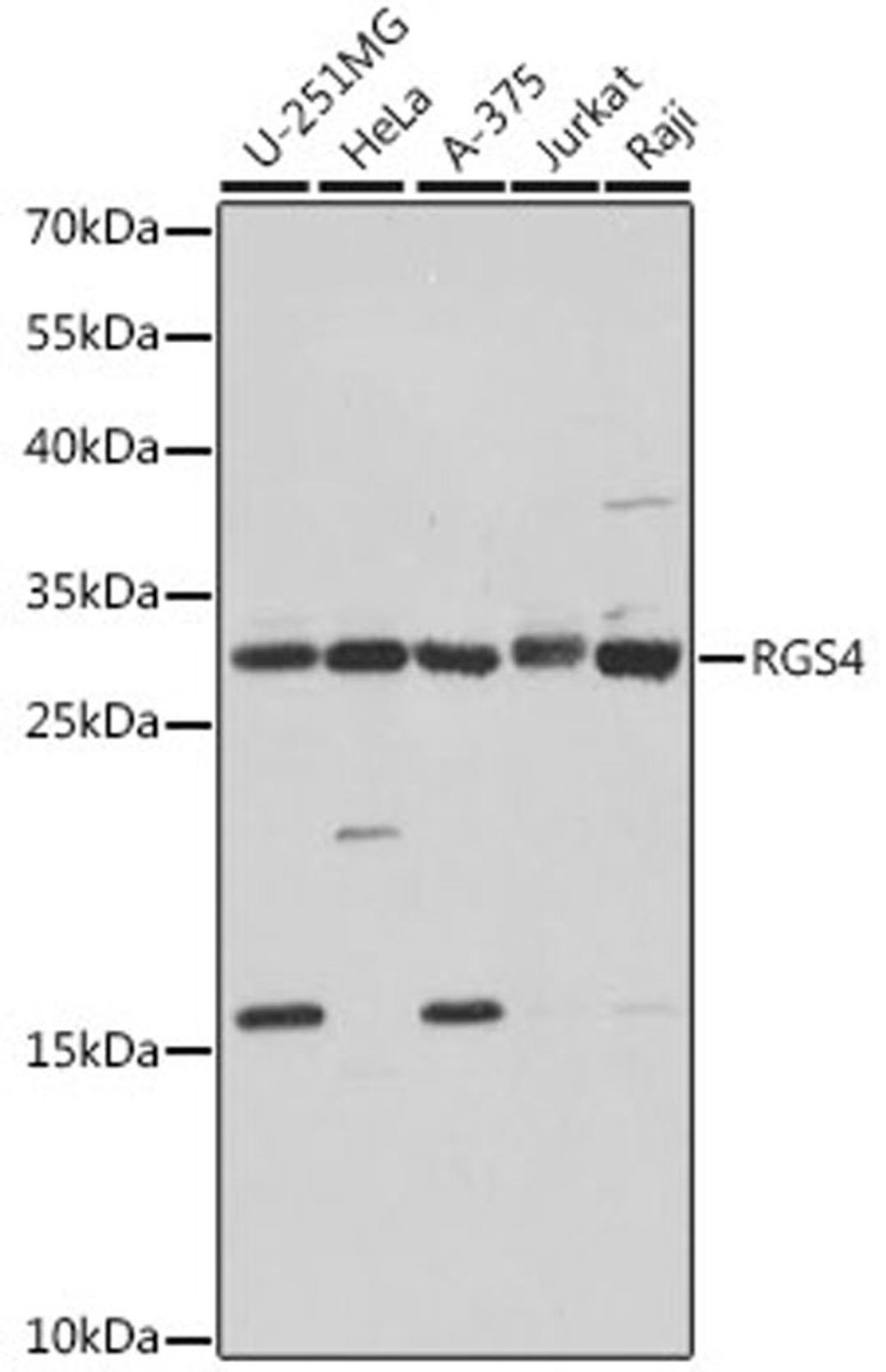 Western blot - RGS4 antibody (A1787)