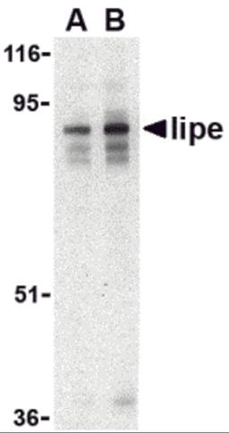 Western blot analysis of Lipe in human lymph node tissue lysate with Lipe antibody at (A) 0.5 and (B) 1 &#956;g/mL.