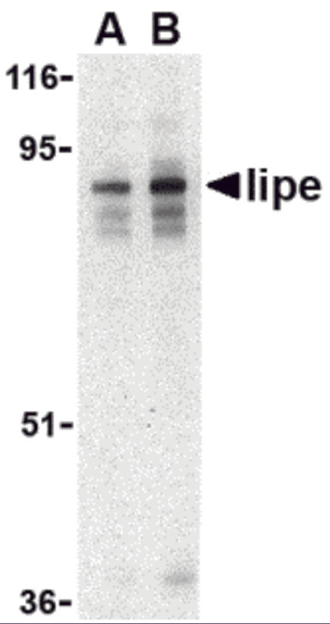 Western blot analysis of Lipe in human lymph node tissue lysate with Lipe antibody at (A) 0.5 and (B) 1 μg/mL.