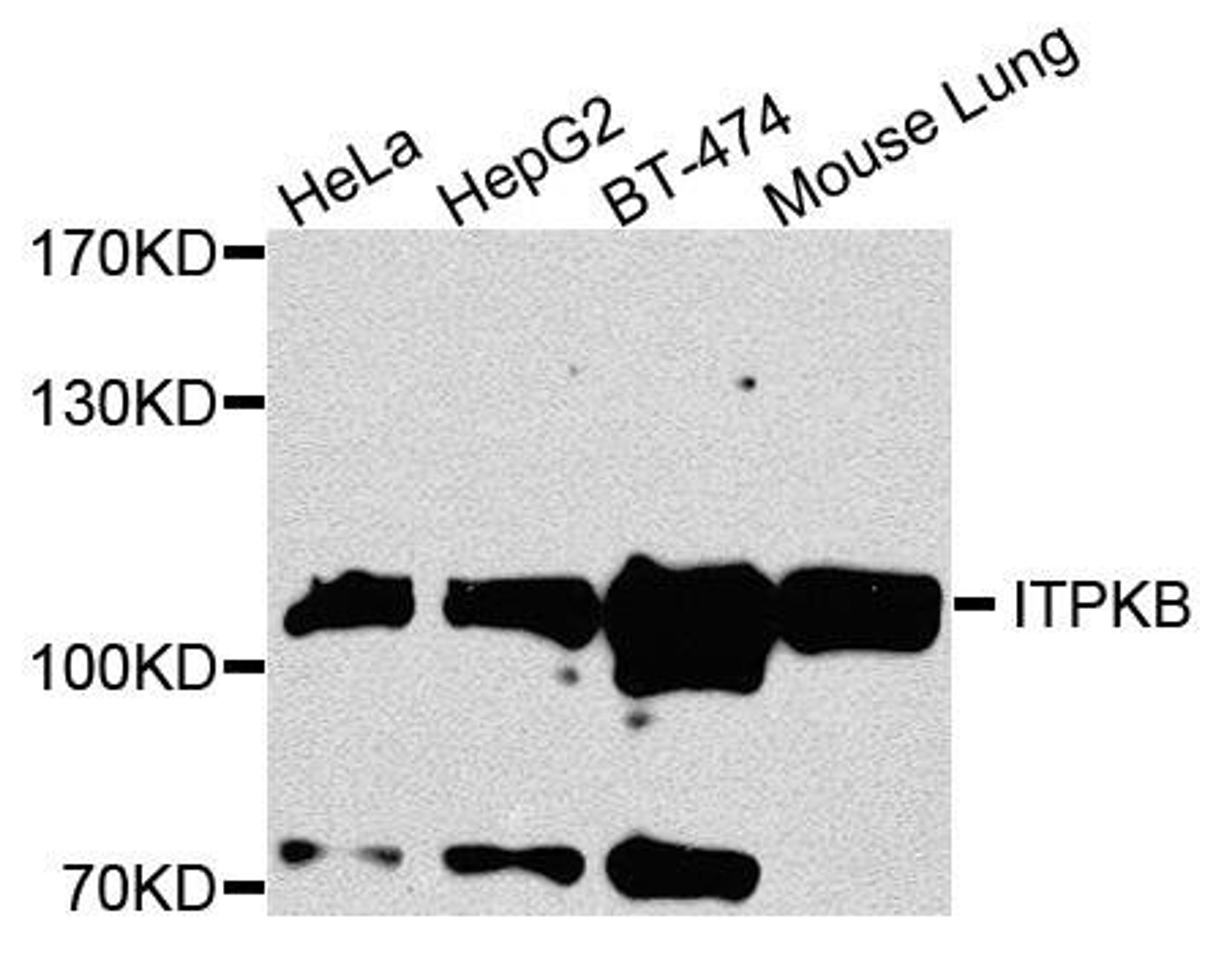 Western blot analysis of extracts of various cells using ITPKB antibody