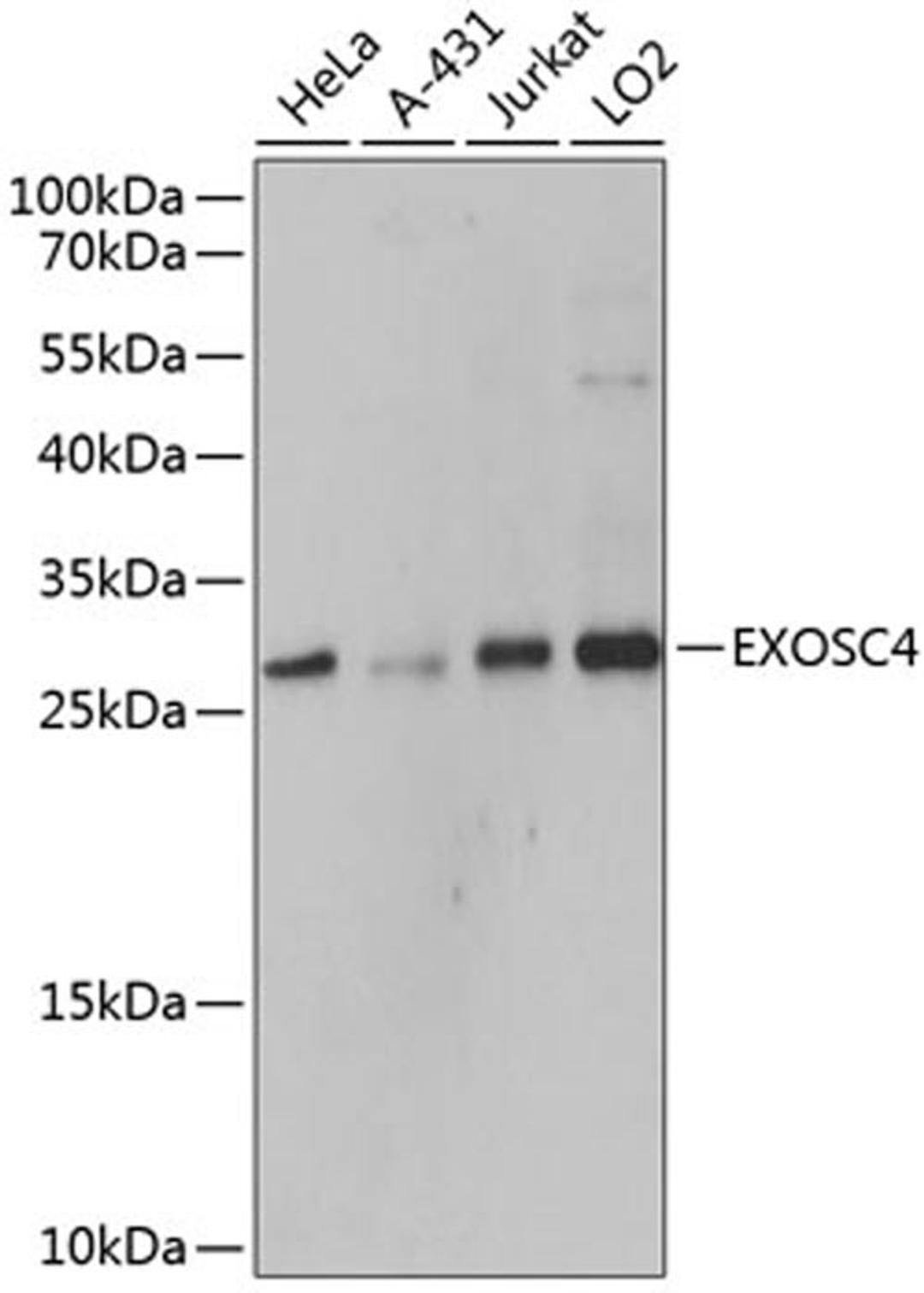 Western blot - EXOSC4 antibody (A9147)