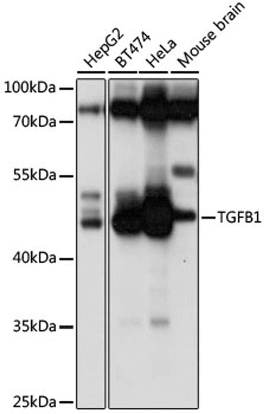 Western blot - TGFB1 antibody (A15103)