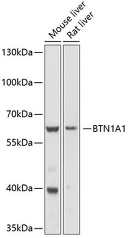 Western blot - BTN1A1 antibody (A10107)