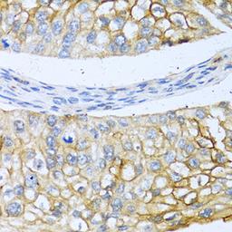 Immunohistochemistry - BMP4 antibody (A11315)