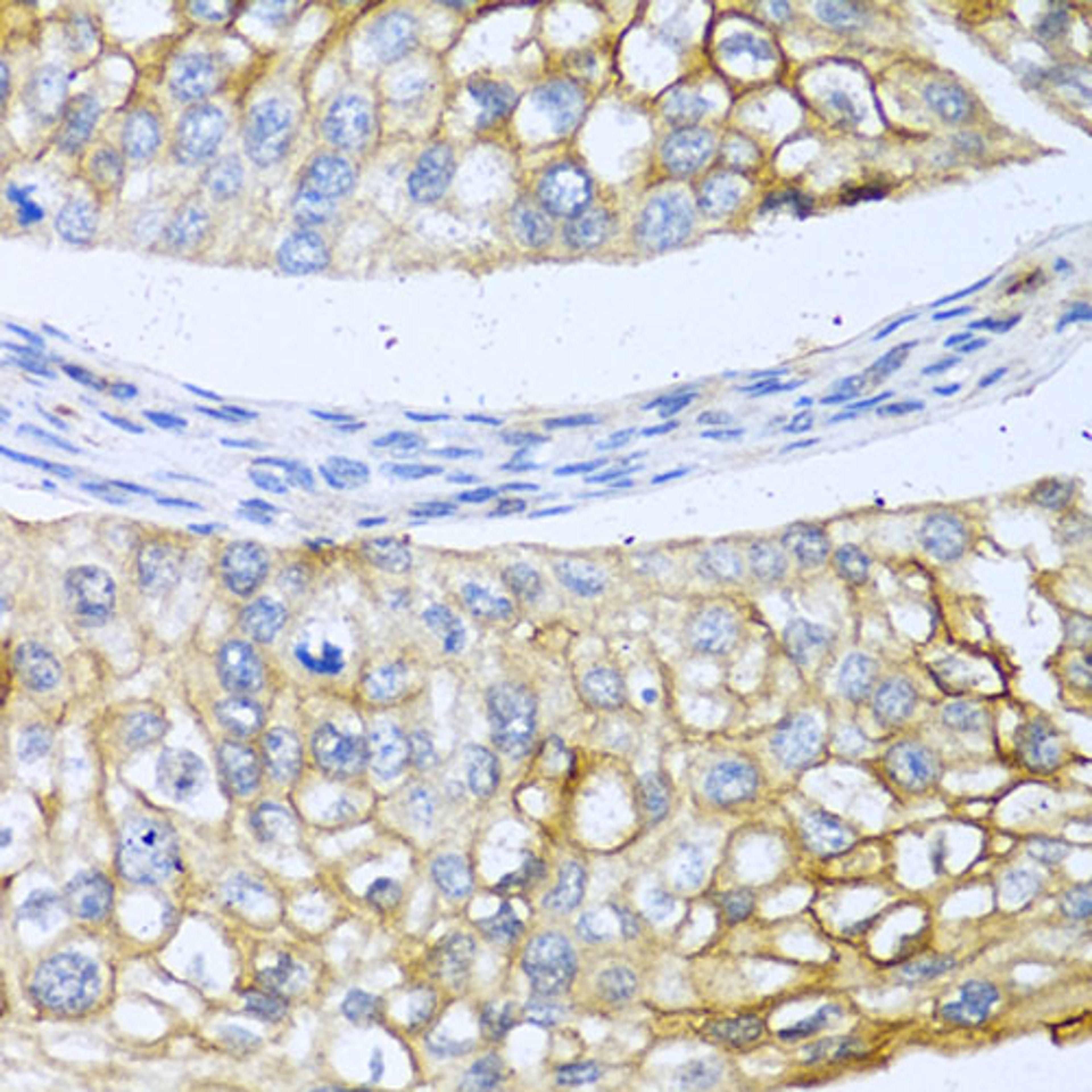 Immunohistochemistry - BMP4 antibody (A11315)