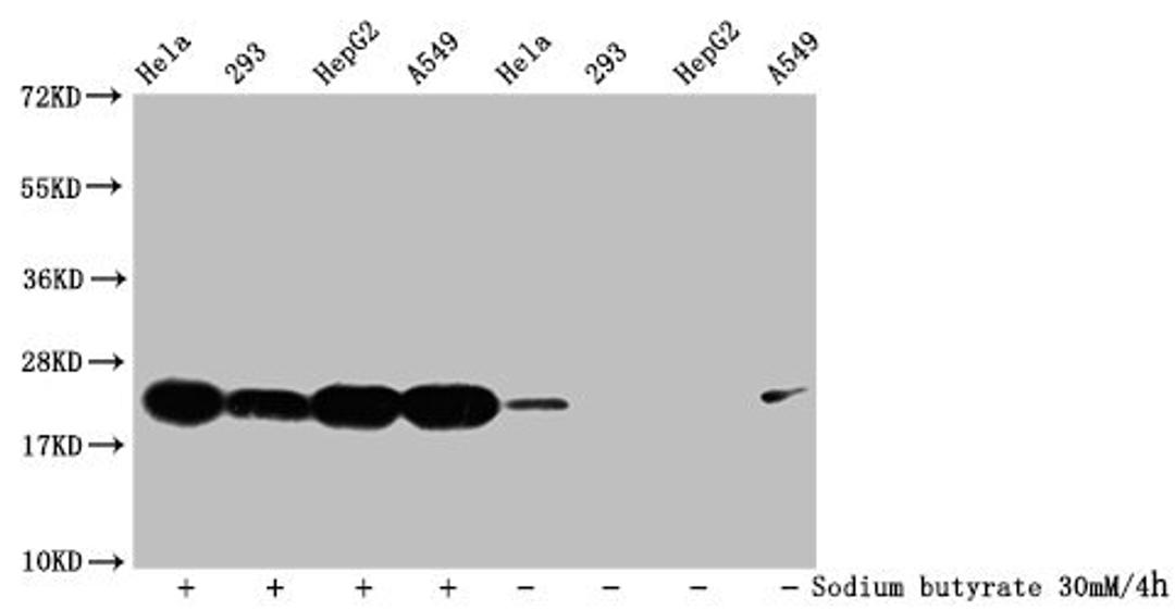Western Blot. Detected samples: Hela whole cell lysate, 293 whole cell lysate, HepG2 whole cell lysate, A549 whole cell lysate; Untreated (-) or treated (+) with 30mM sodium butyrate for 4h. All lanes: HIST1H1C antibody at 1:500. Secondary. Goat polyclonal to rabbit IgG at 1/40000 dilution. Predicted band size: 22 kDa. Observed band size: 22 kDa