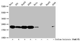 Western Blot. Detected samples: Hela whole cell lysate, 293 whole cell lysate, HepG2 whole cell lysate, A549 whole cell lysate; Untreated (-) or treated (+) with 30mM sodium butyrate for 4h. All lanes: HIST1H1C antibody at 1:500. Secondary. Goat polyclonal to rabbit IgG at 1/40000 dilution. Predicted band size: 22 kDa. Observed band size: 22 kDa
