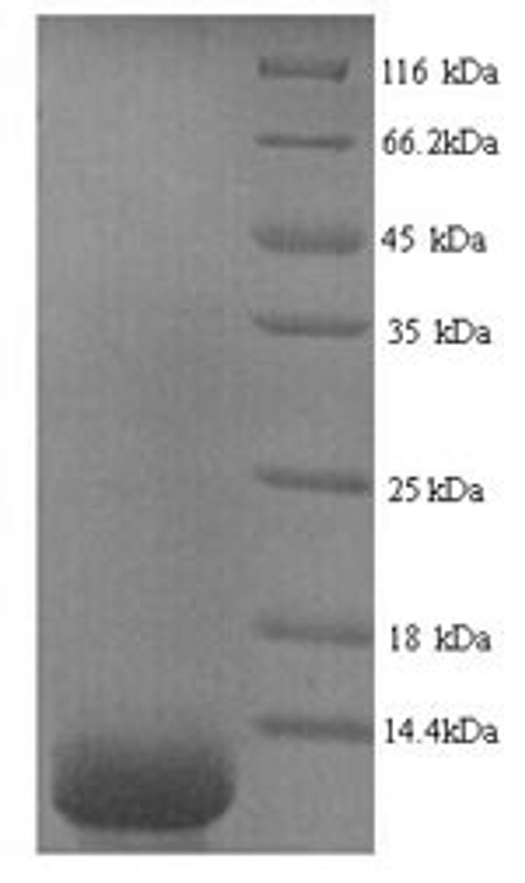 (Tris-Glycine gel) Discontinuous SDS-PAGE (reduced) with 5% enrichment gel and 15% separation gel.