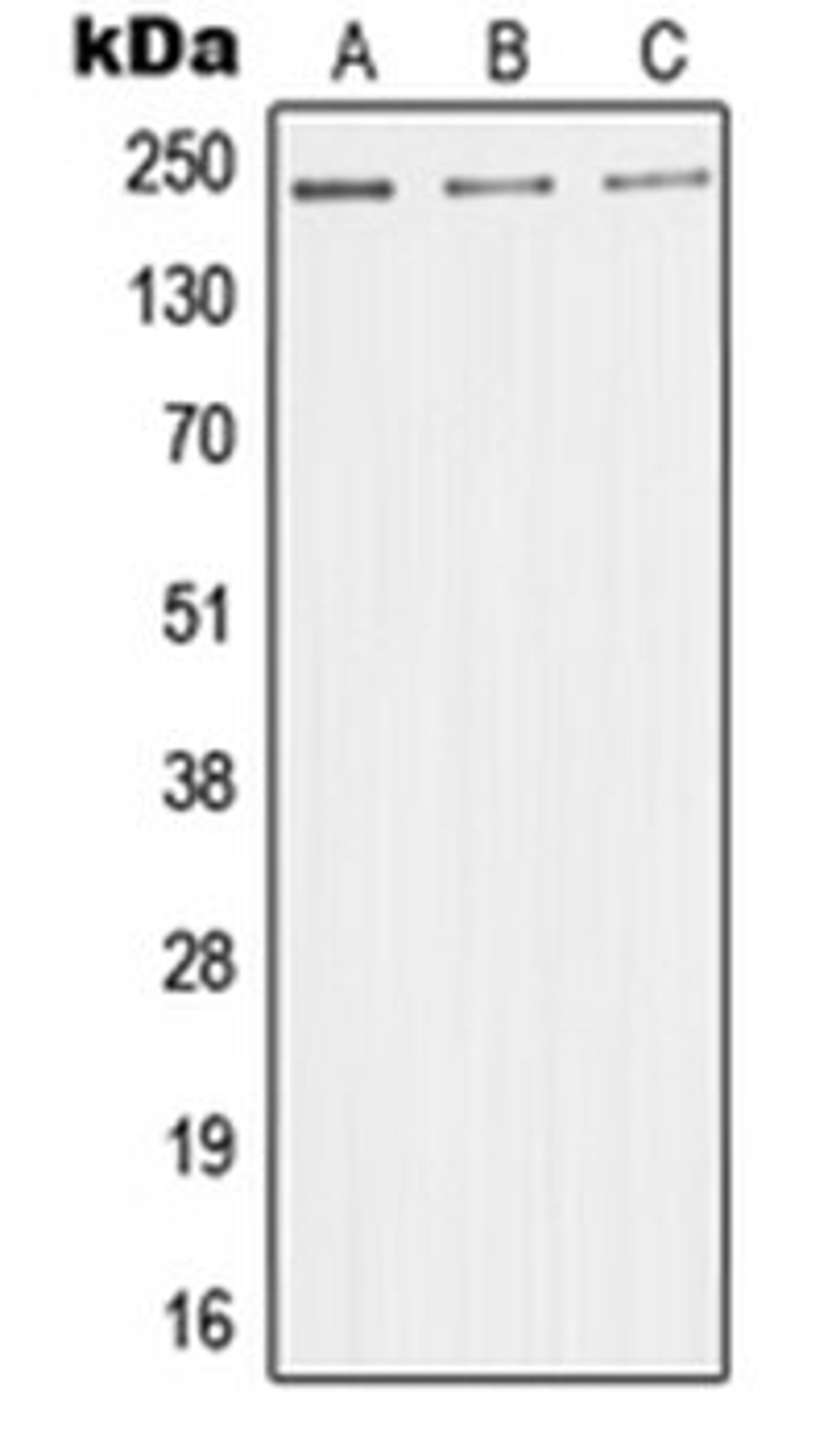 Western blot analysis of HeLa (Lane 1), HuvEc (Lane 2), Jurkat (Lane 3) whole cell lysates using MED1 antibody