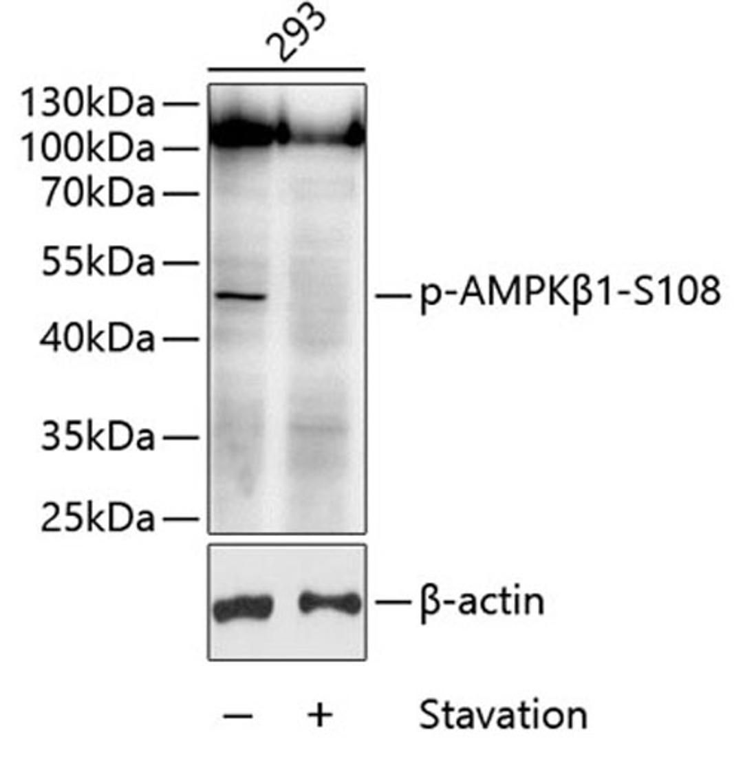 Western blot - Phospho-AMPKß1-S108 antibody (AP0597)