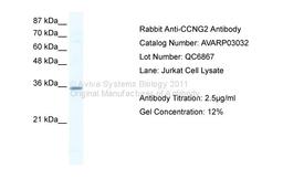 Antibody used in WB on Human Jurkat 2.5 ug/ml.