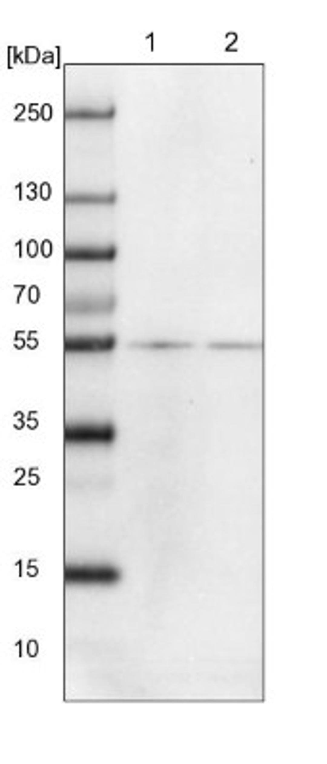 Western Blot: TUBB8 Antibody [NBP2-13494] - Lane 1: NIH-3T3 cell lysate (Mouse embryonic fibroblast cells)<br/>Lane 2: NBT-II cell lysate (Rat Wistar bladder tumour cells)