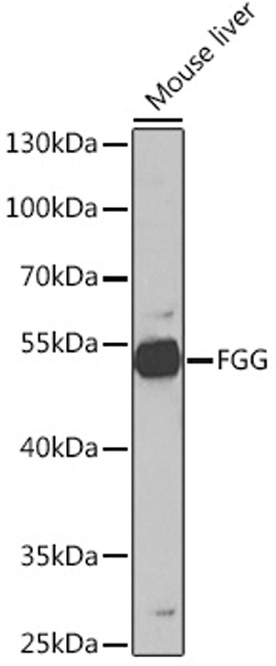 Western blot - FGG Rabbit pAb (A5642)