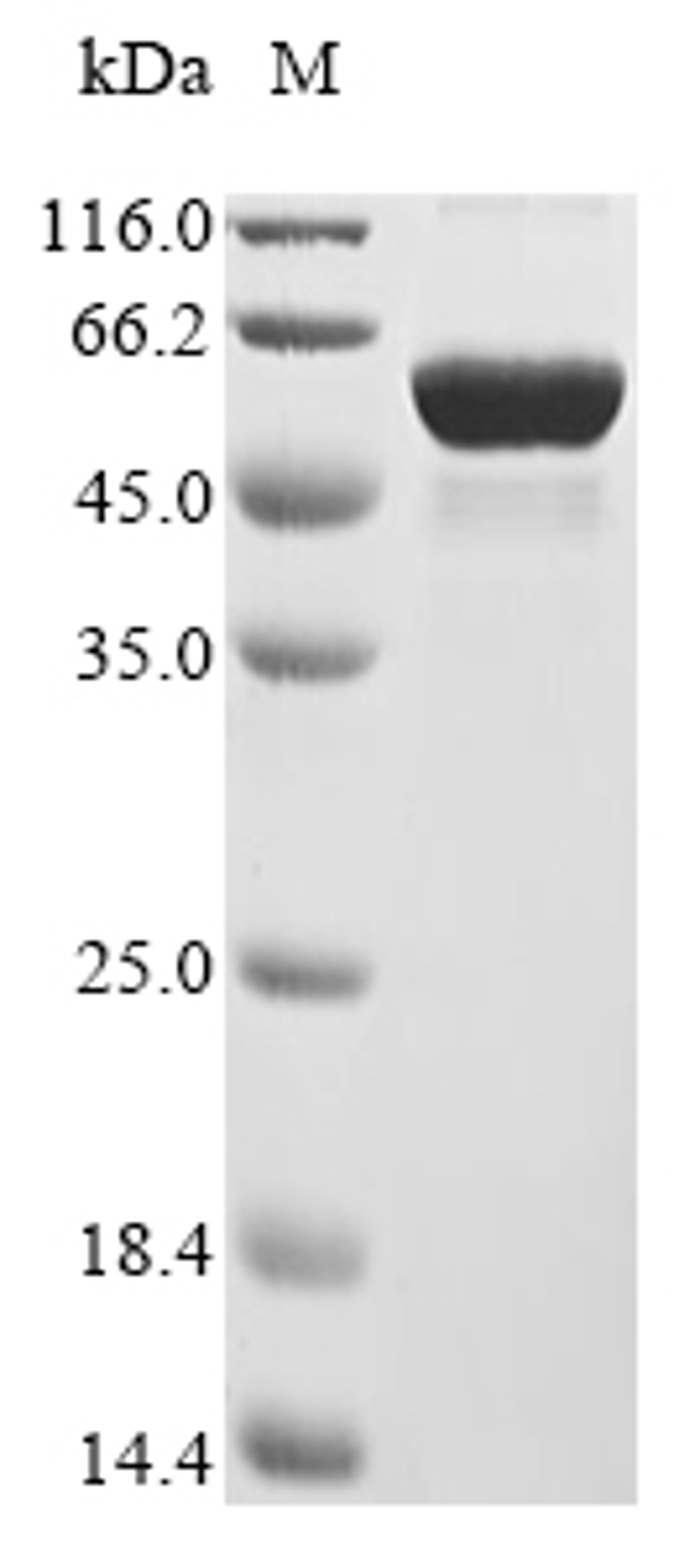 (Tris-Glycine gel) Discontinuous SDS-PAGE (reduced) with 5% enrichment gel and 15% separation gel.
