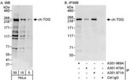 Detection of human ch-TOG by western blot and immunoprecipitation.