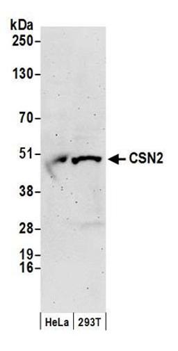 Detection of human CSN2 by western blot.